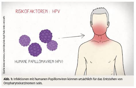 hpv virus übertragung auf mann